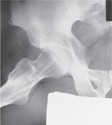 <p>What is the projection and anatomy shown in this image?</p>