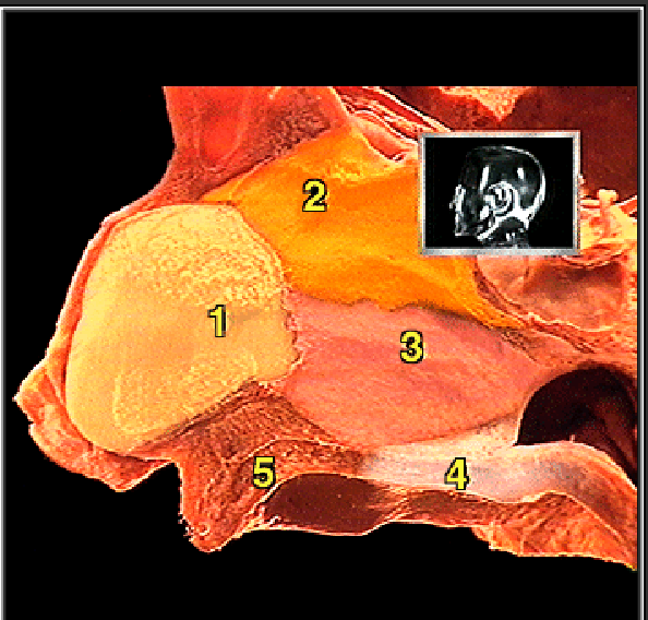 <p>what structure is #3?</p>