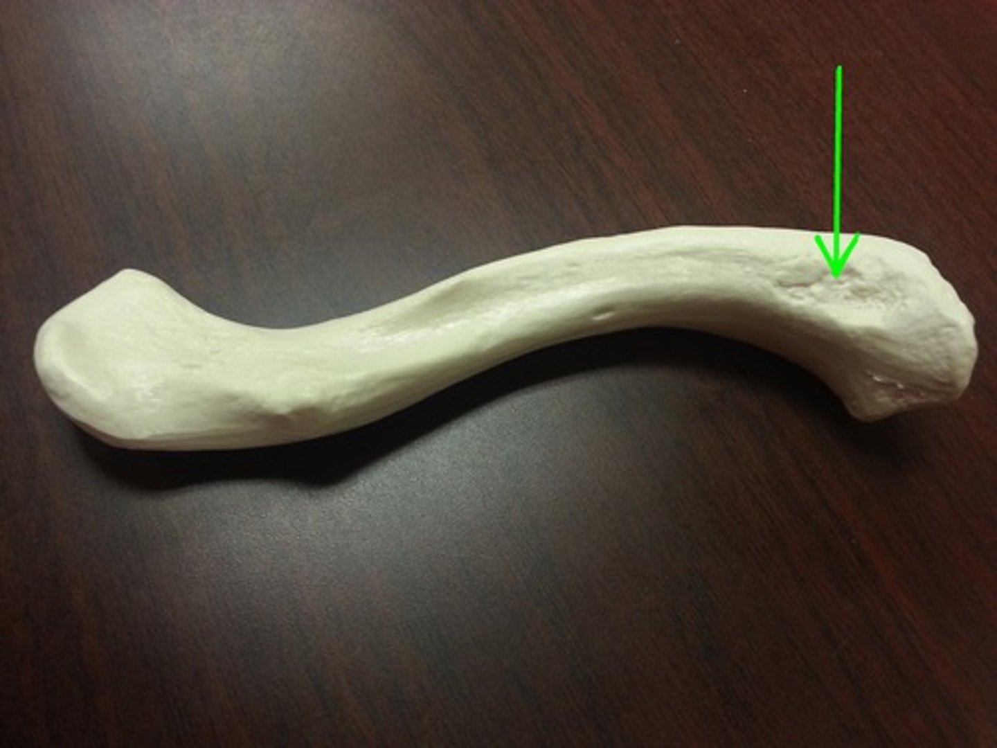 <p>broad, roughened spot on the inferior surface of the medial aspect of the clavicle</p>