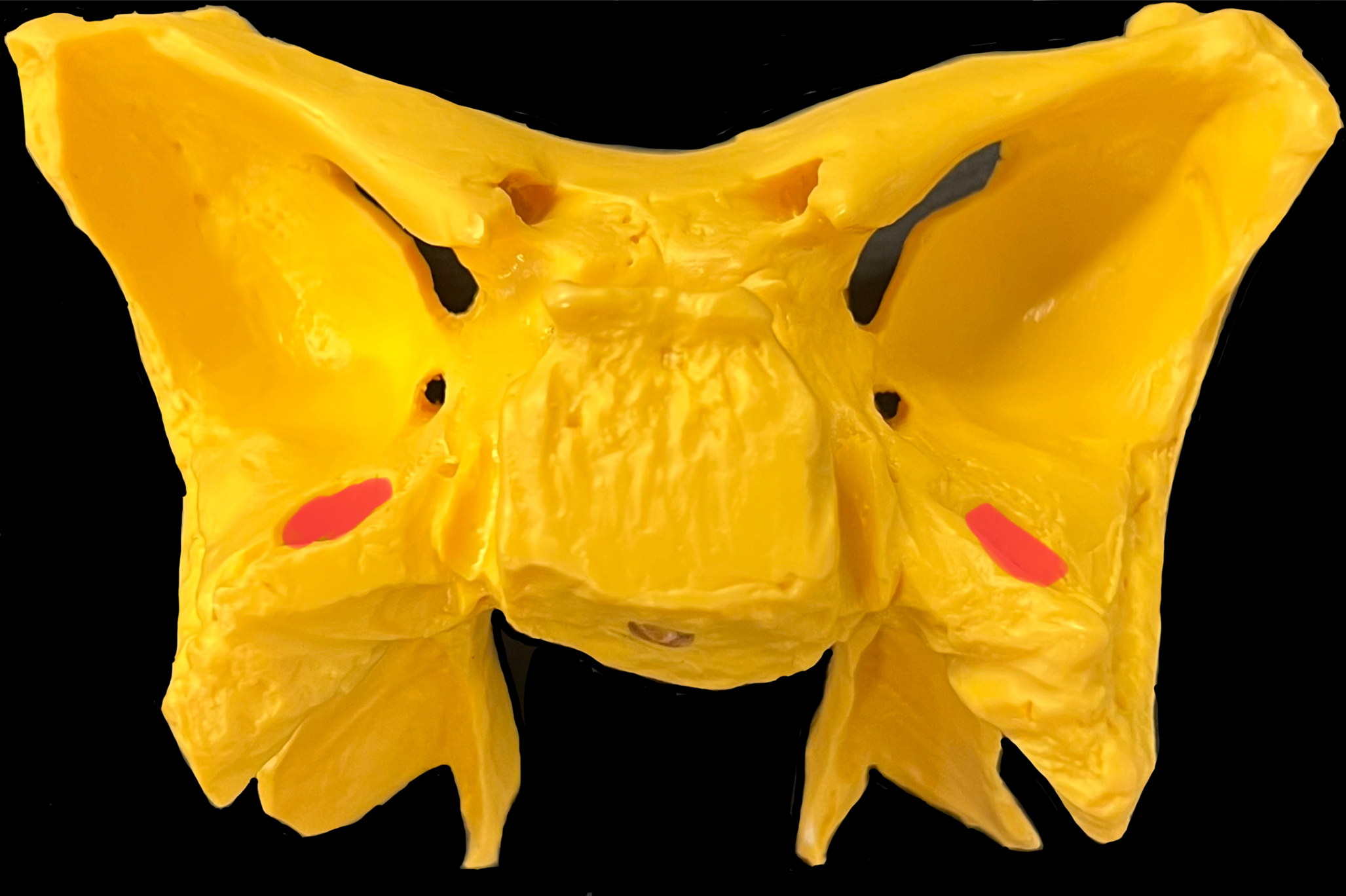 What is highlighted in red?