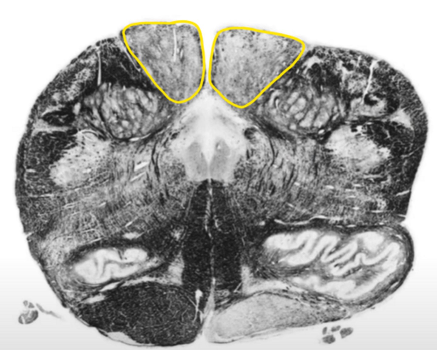 <p>ID the nucleus</p>