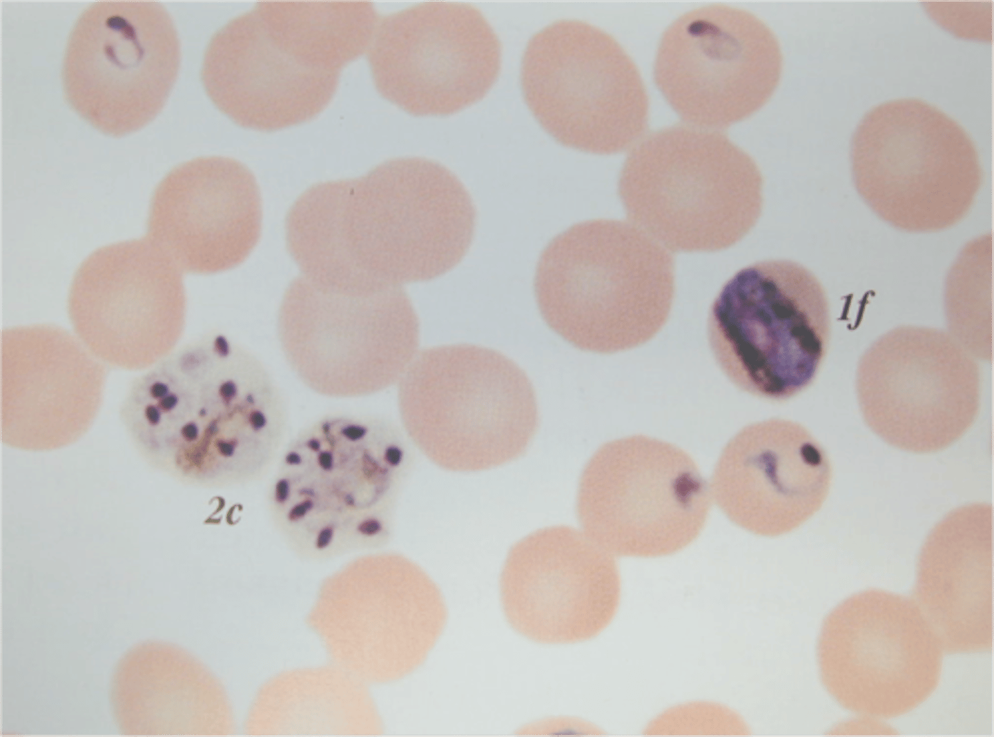 <p>Plasmodium malariae</p>