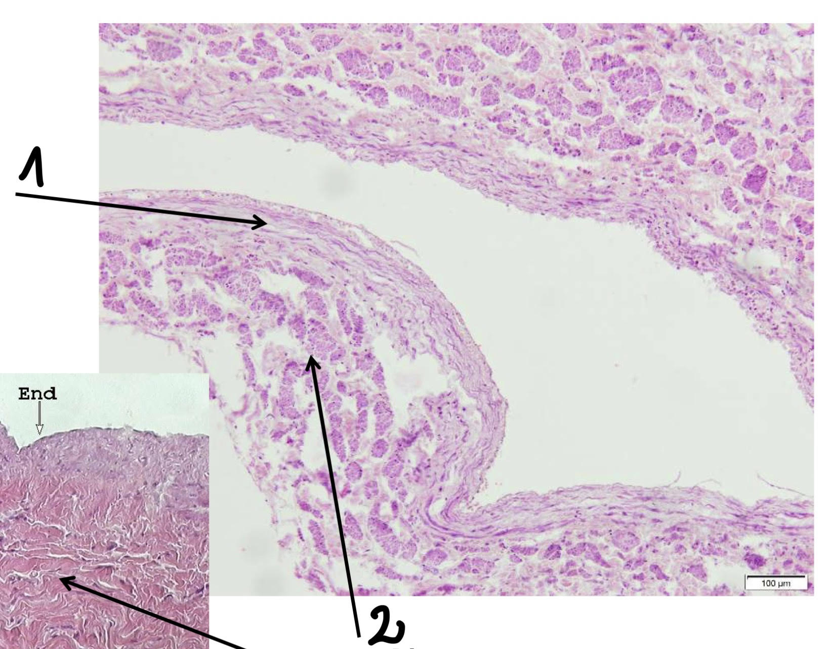 term image