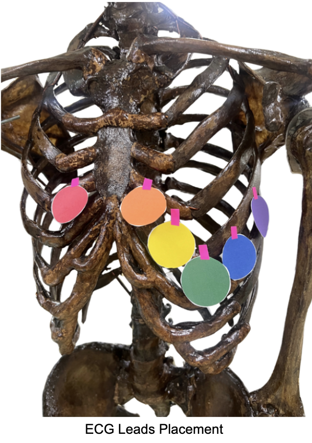 <p>Where is the: (answer using colors) <span>5th ICS, Left Mid-Clavicular Line</span></p>