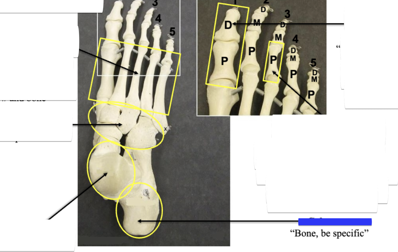 <p>Bone be specific </p>