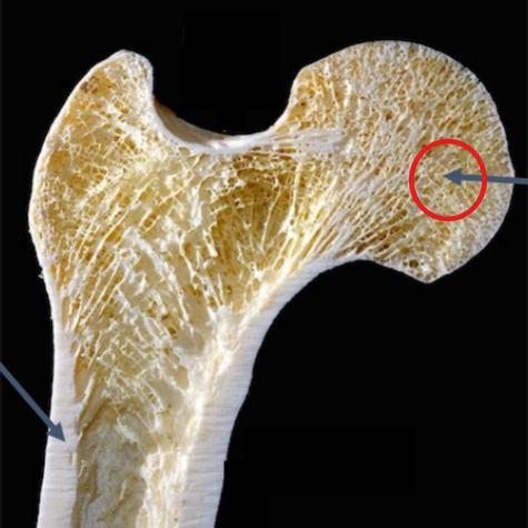 <p>“Spongy bone” found <strong>inside </strong>long / flat / irregular bones</p>