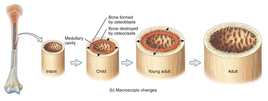 <p>the addition of new bone tissue by osteoblasts around the outer surface of the bone and to a lesser extent internal bone dissolution by osteoclasts in the bone cavity​</p>