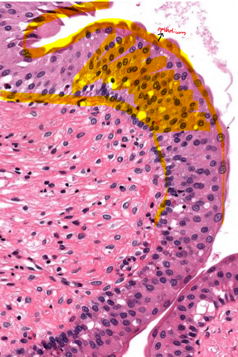 <p>What is the type of epithelium present in the image?</p>