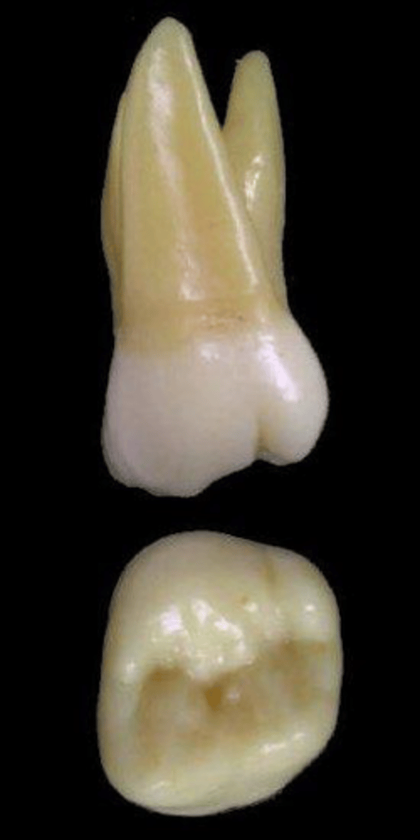 <p>what tooth is this &amp; why?</p>