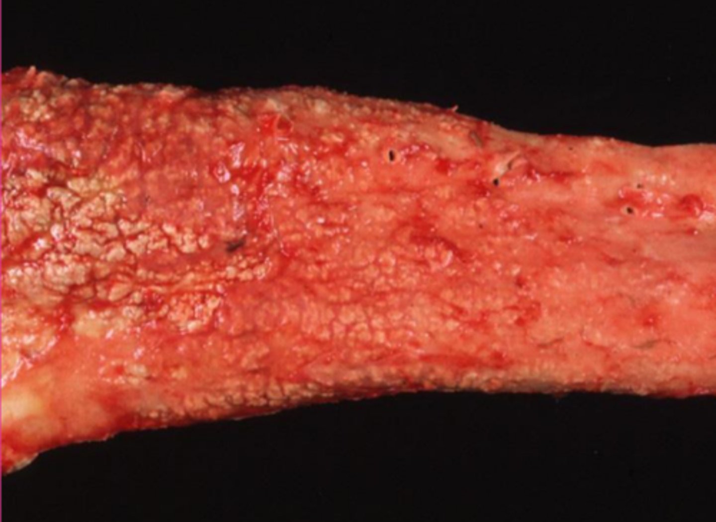 <p>what would make this aorta look like that?</p>
