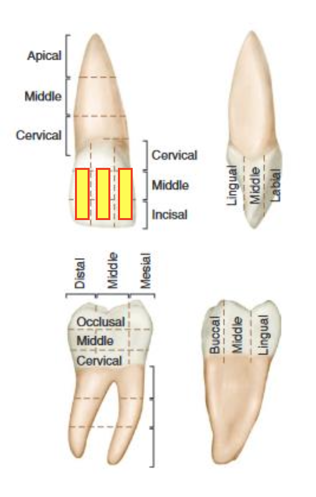 term image