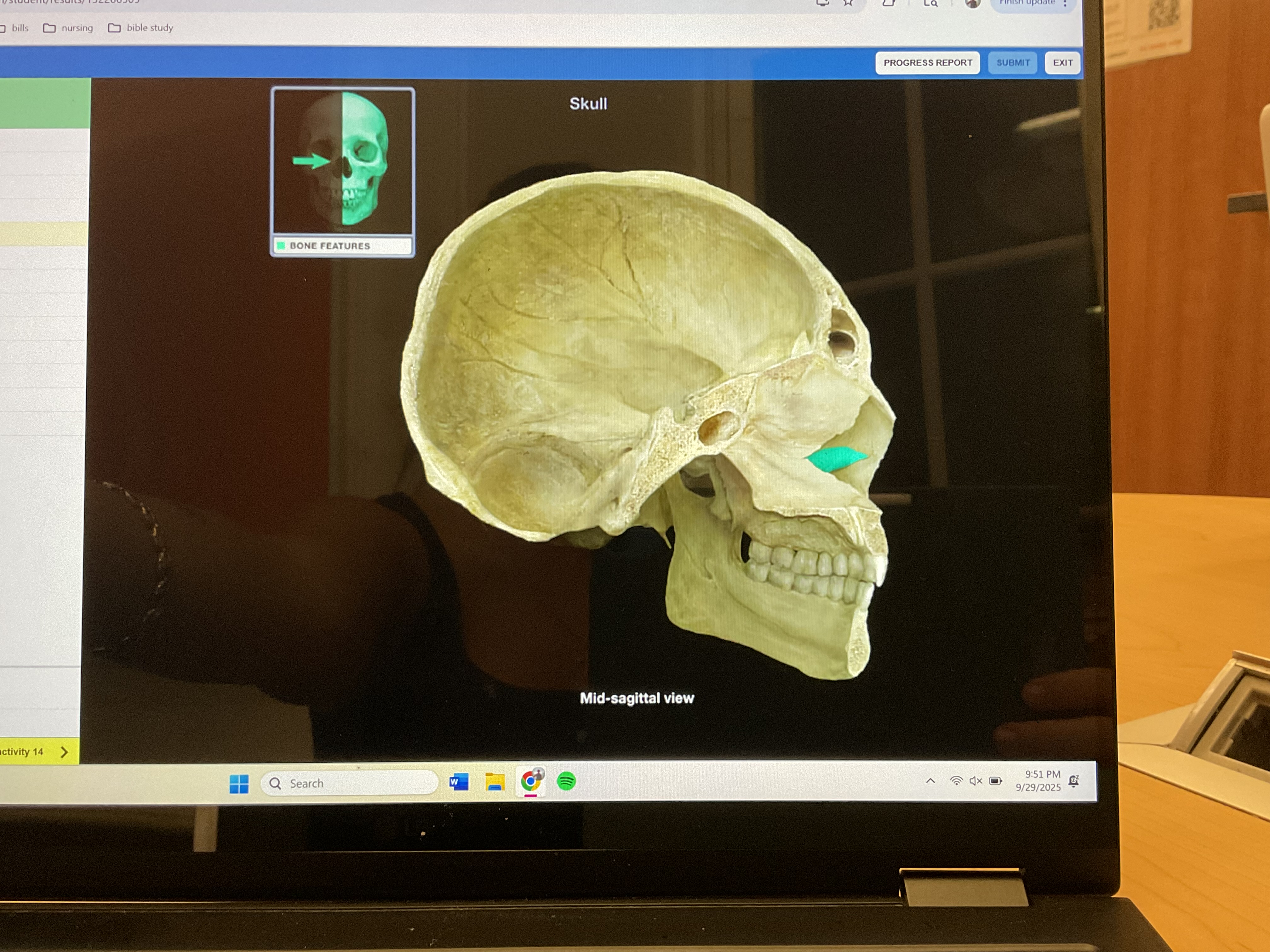 <p>Inferior nasal concha</p>