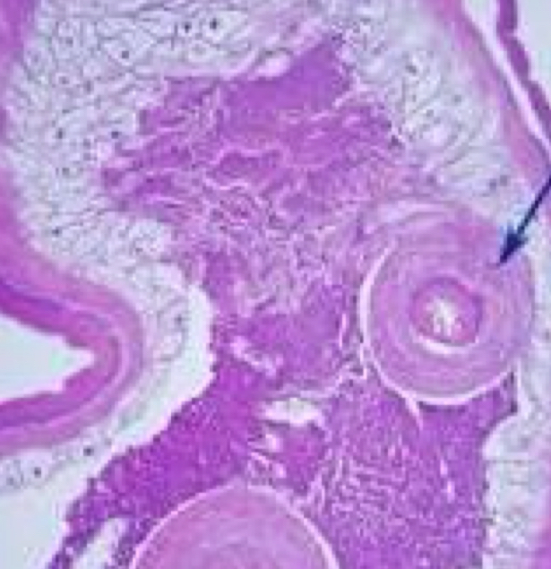 <p>Trichuris Trichiura adult</p>