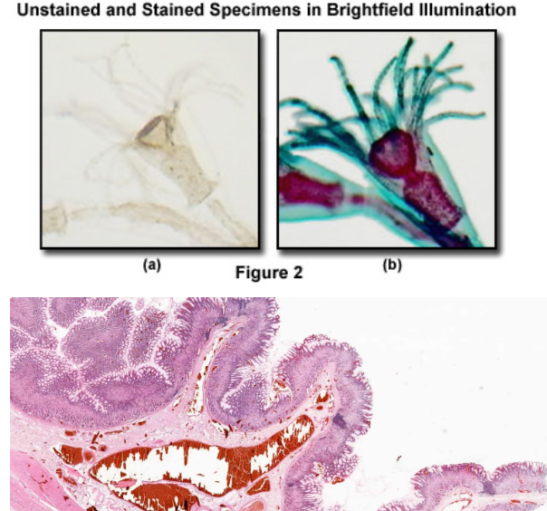 <ul><li><p>Specimens must be stained and put in a beam of illuminating light</p><ul><li><p>Provides color contrasting characterization</p></li></ul></li><li><p>Produces high resolution image through focus</p></li><li><p>Viewed under oil immersion on a microscopic slide</p></li><li><p>Could be used to observe cell growth</p></li></ul><p></p>