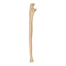 <p>Ulna</p>