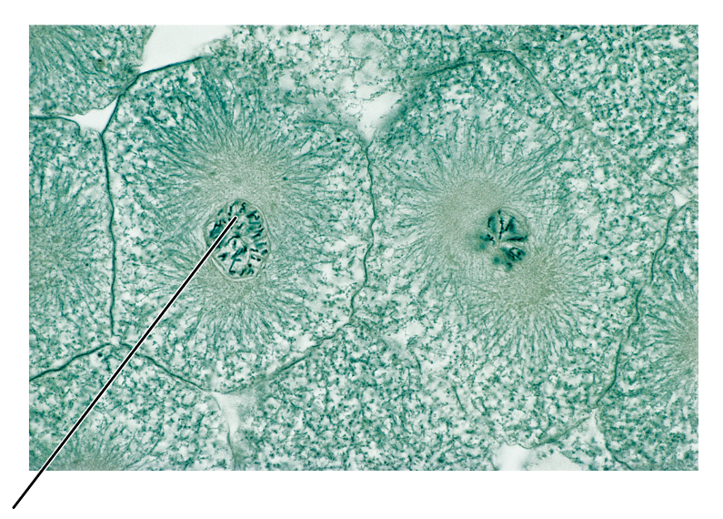 <p>What stage of mitosis is shown by this cell?</p><p>(Cross section of whitefish blastula).</p>
