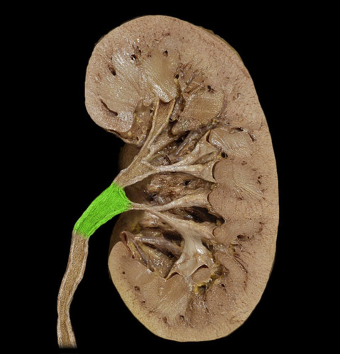 <p>funnel-shaped reservoir that collects the urine and passes it to the ureter; collection</p>