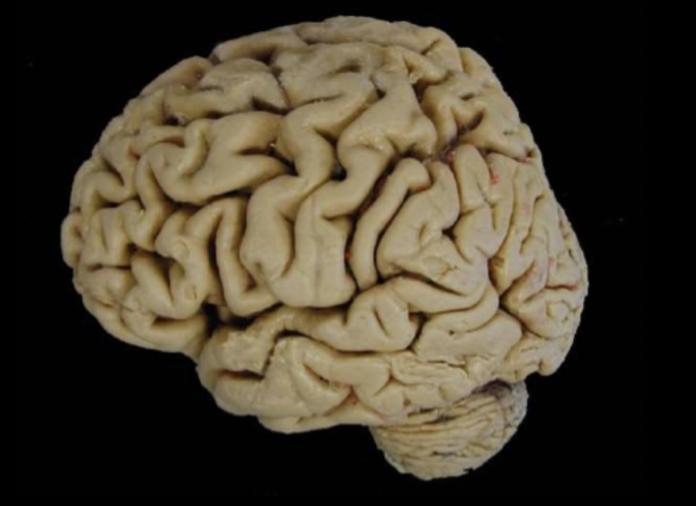 <p>What view of the brain is this?</p>