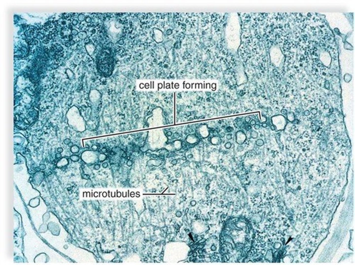 <p>The structure that forms during cytokinesis in plant cells to build a new cell wall.</p>
