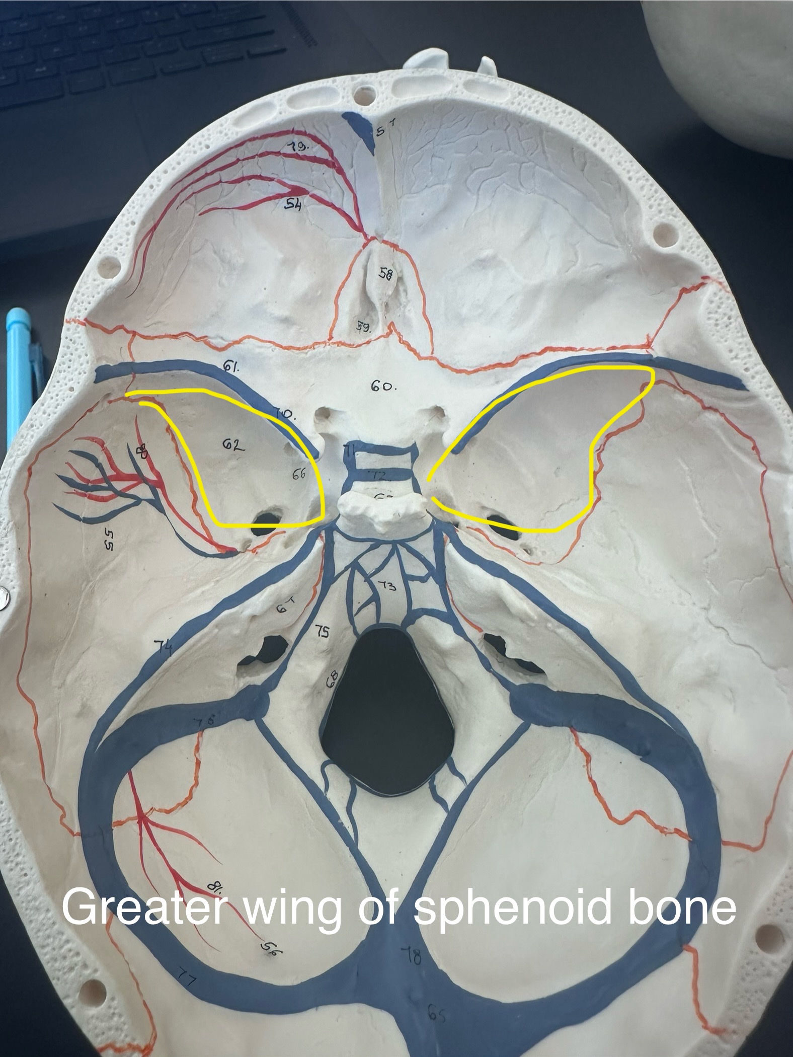 <p>Greater wing of sphenoid bone</p>