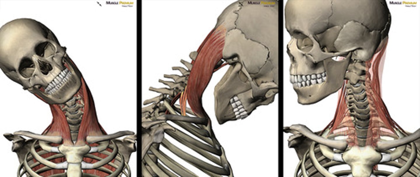 <p>rotation of the head to the opposite side + lateral flexion of the neck</p><p>extend neck at atlanto-occipital joint</p><p>flex cervical vertebrae</p>