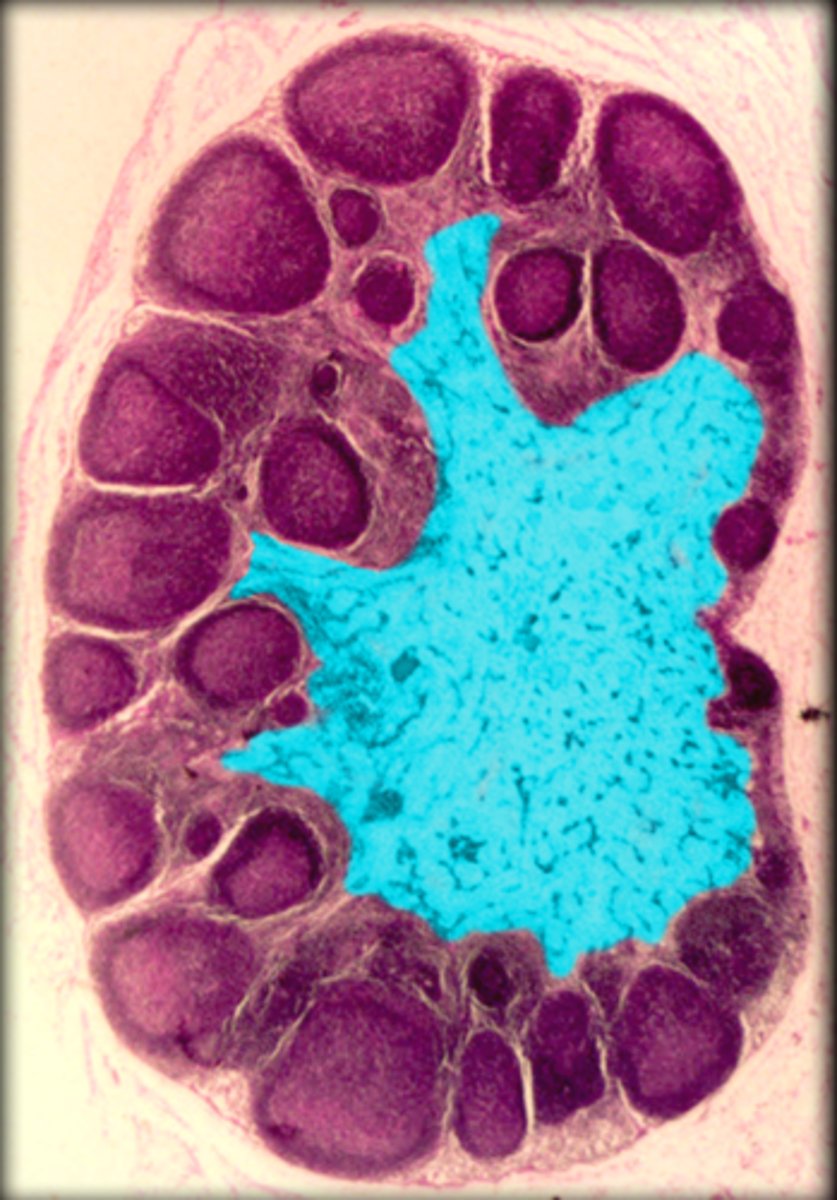 <p>Lymph node</p>