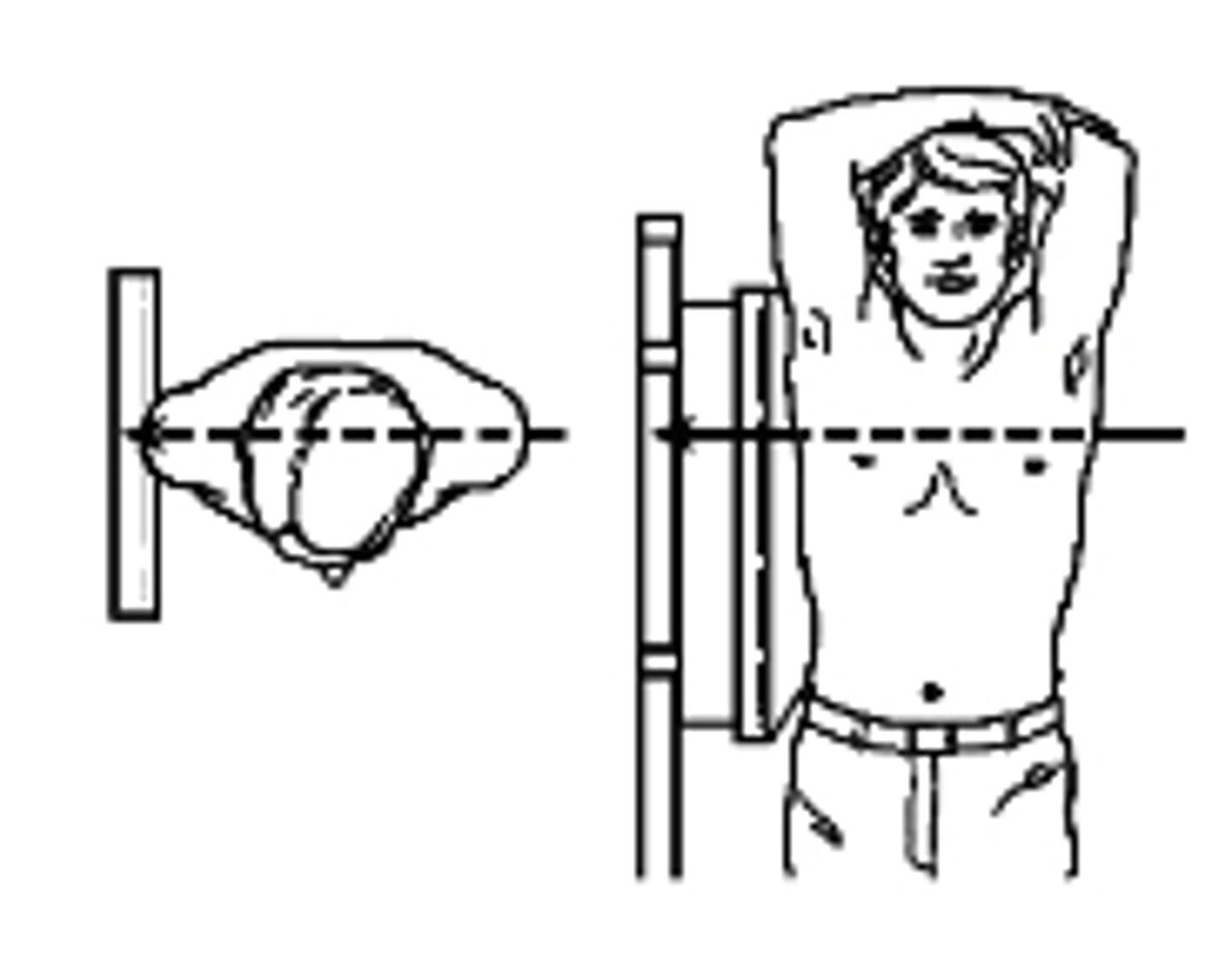 <p>what type of projection is this?</p><p>a. Left lateral</p><p>b. Right Lateral</p><p>c. Left AP Oblique</p><p>c. Right AP Oblique</p>