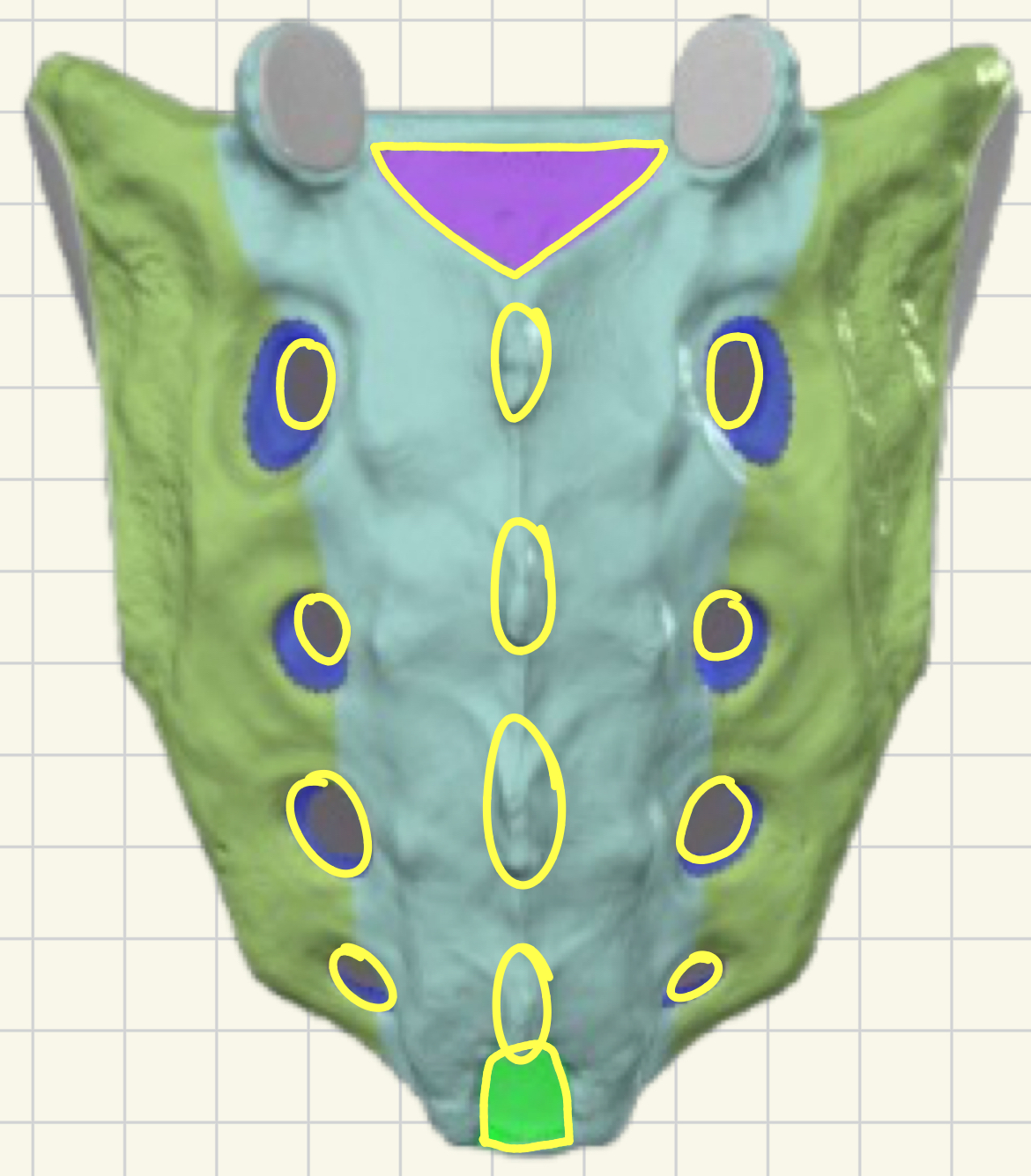 <p>What bone is this?</p>