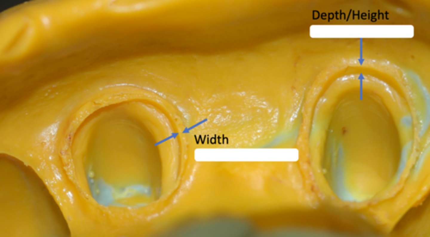 <p>Depth of the impression cuff needs to be at least____ mm (more is better)</p>