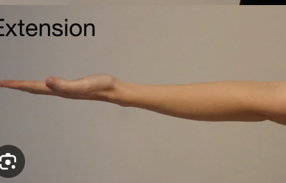 <p>Elbow Extension</p>