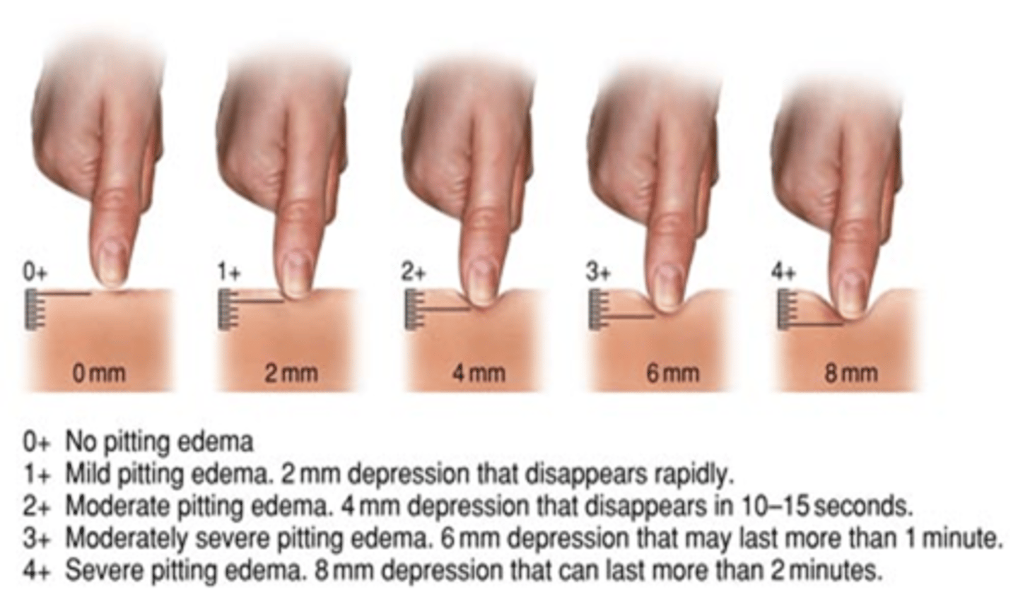 <p>Temperature and Moisture - use the back of hands to examine and check from head to feet</p><p>Texture and thickness</p><p>Mobility and turgor - mobility is how much the skin moves, turgor is the ability to come back to normal, pulling up skin then letting go.</p><p>Swelling (Edema) and pitting edema (in legs push in and let go, how long does the indent go.</p>