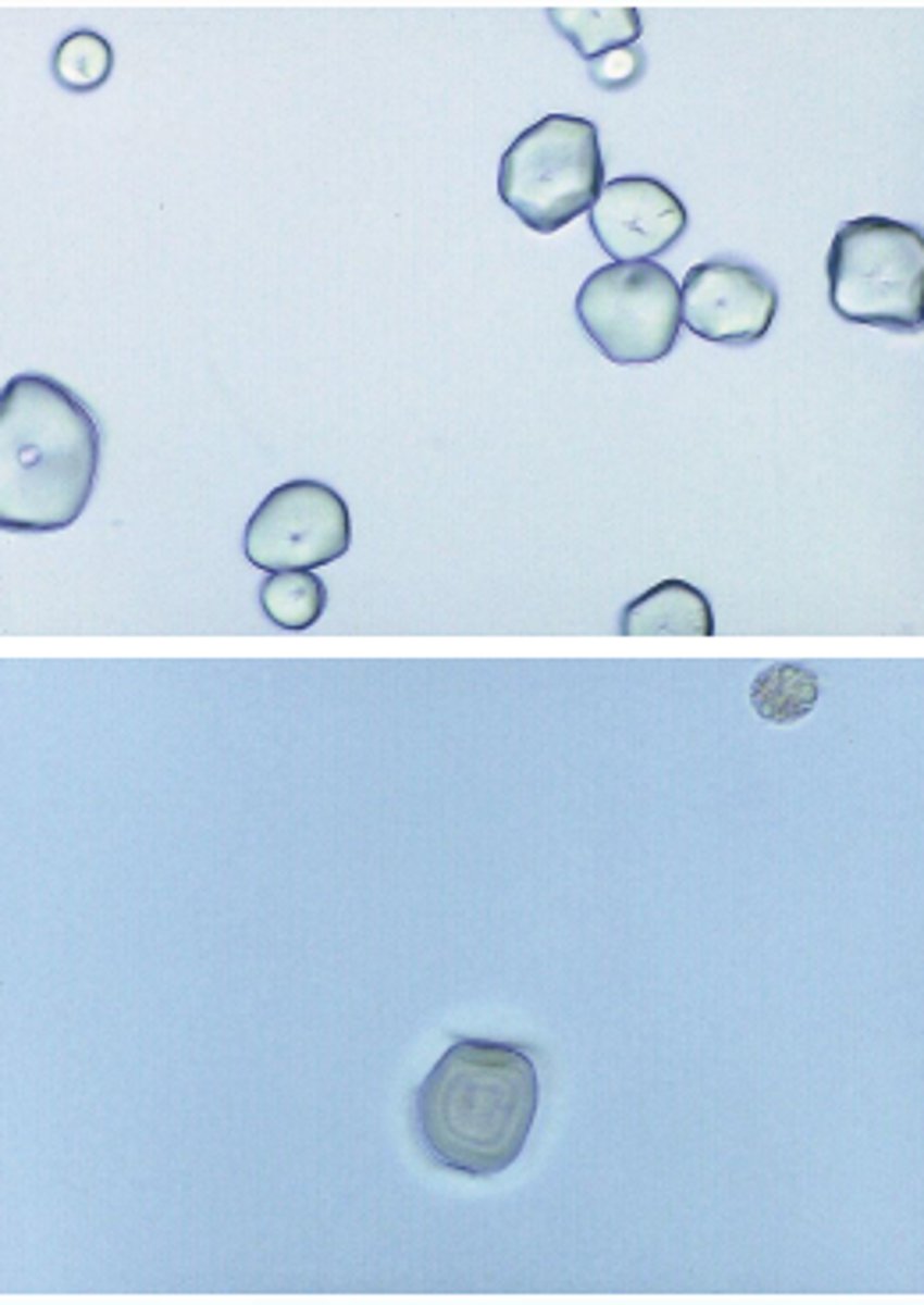 <p>Material fibers, meat<br>and vegetable fibers,<br>and hair<br><br>Starch, oil droplets, air<br>bubbles, pollen grains,<br>vegetable fiber, hair,<br>diaper fiber</p>