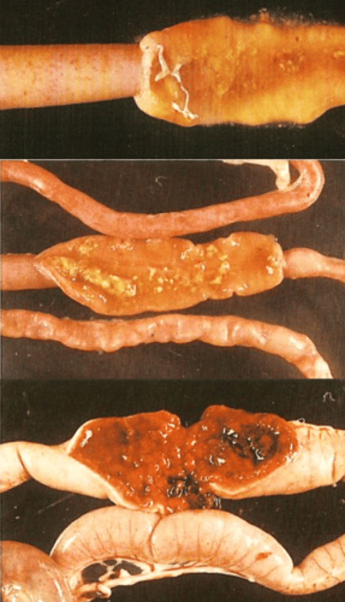 <p>Locates in the jejunum and caeca;</p><p>2nd generation schizonts are the pathogenic stage;</p><p>White plaques or petechiae may be visible from the serosal surface;</p><p>Intestinal content streaked with blood;</p><p>Ballooning, hemorrhages;</p><p>On gut scrapings of the jejunum: large schizonts (60μm) that are diagnostic for this species;</p><p>No oocysts in the jejunum</p>