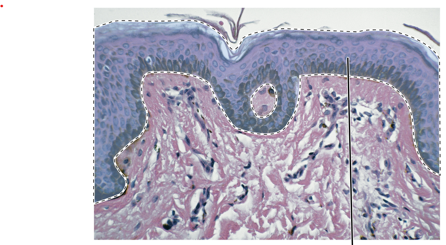 <p>Name the highlighted tissue.</p>