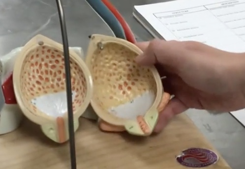 <p>Description: Mucosal folds on the internal surface of the urinary bladder</p><p>Relationship: Allows for distension of the urinary bladder</p>