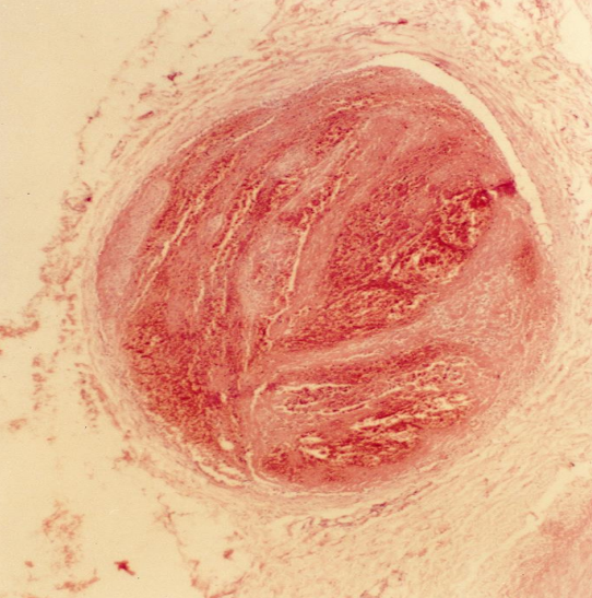term image