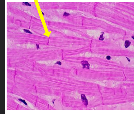 <p>what tissue is this</p>