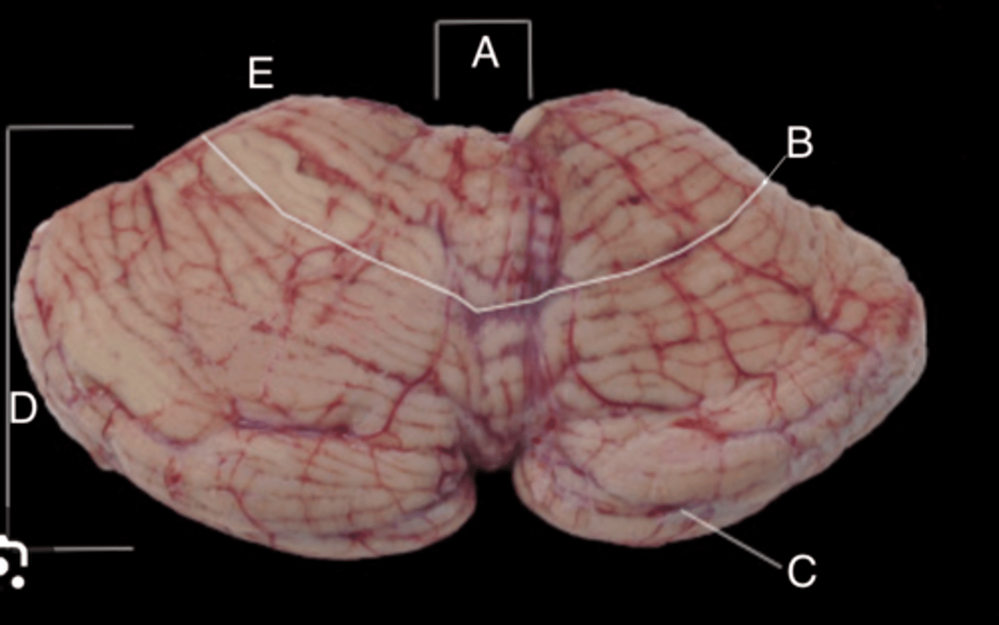 <p>A?</p>