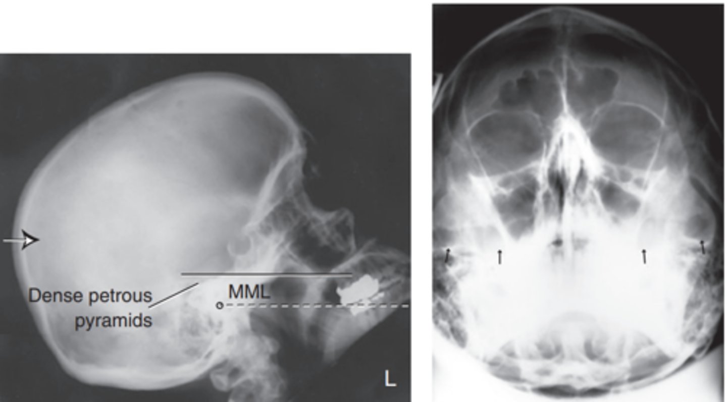 <p>just below the maxillary sinuses</p>
