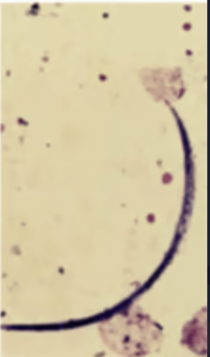 <p>What is this parasite? What characteristic/s did you use to identify it?</p>