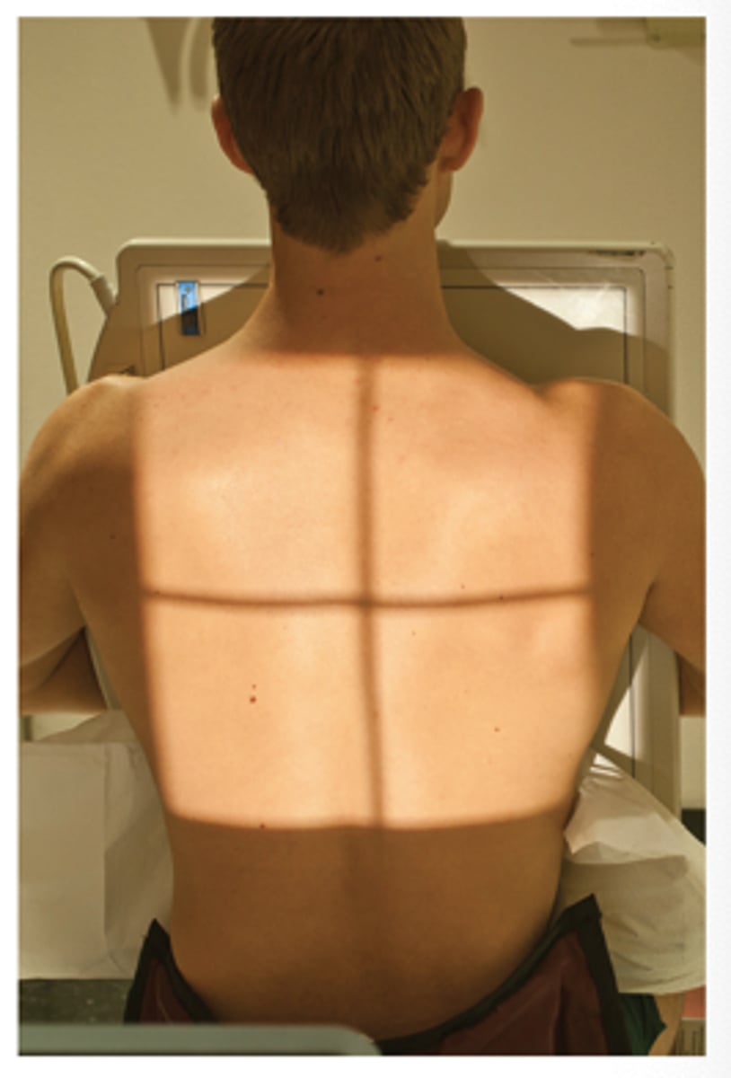 <p>b. False - 1 ½ to 2 inches above the shoulders for the average size patient</p>