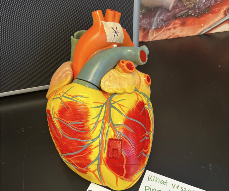 <p>What vessel is pinned? </p>