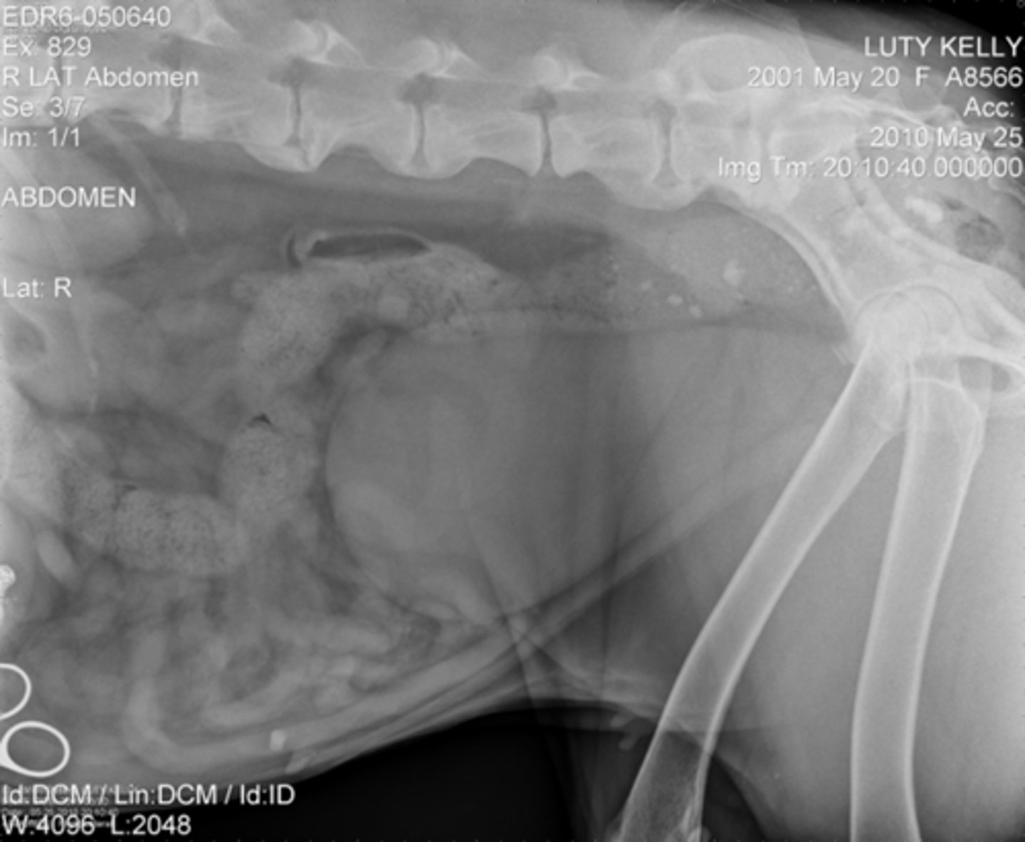 <p>X-rays are short wavelength, high energy waves</p>