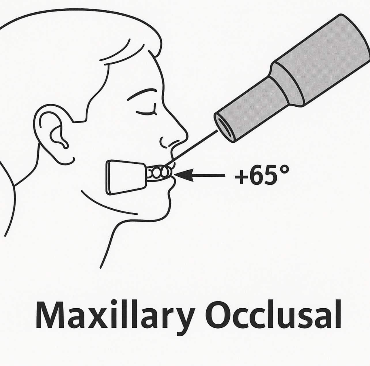<p><span>How is the patient’s head positioned for the maxillary occlusal technique?</span></p>