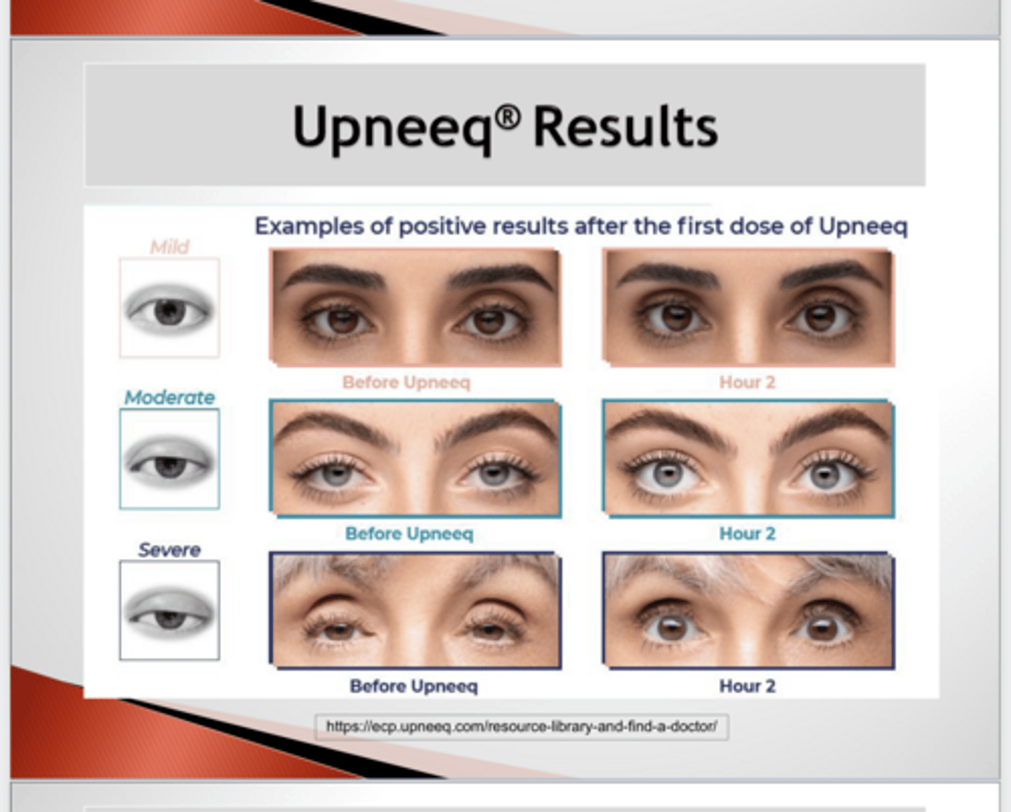 <p>Upneeq Results (PIC)</p>