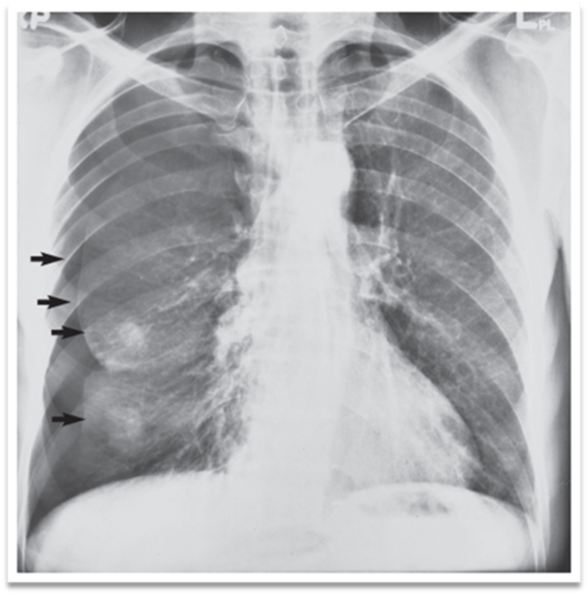 <p>Interpretation?</p>