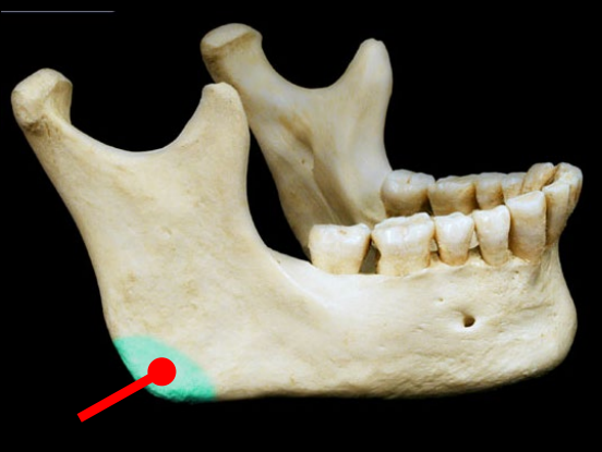 <p>Mandibular angle</p>