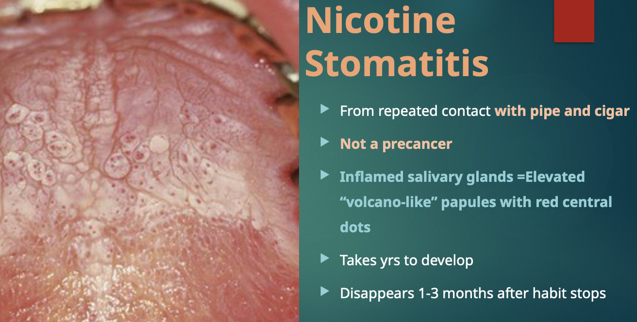 <p>What happens to nicotine stomatitis after the smoking habit stops?</p>