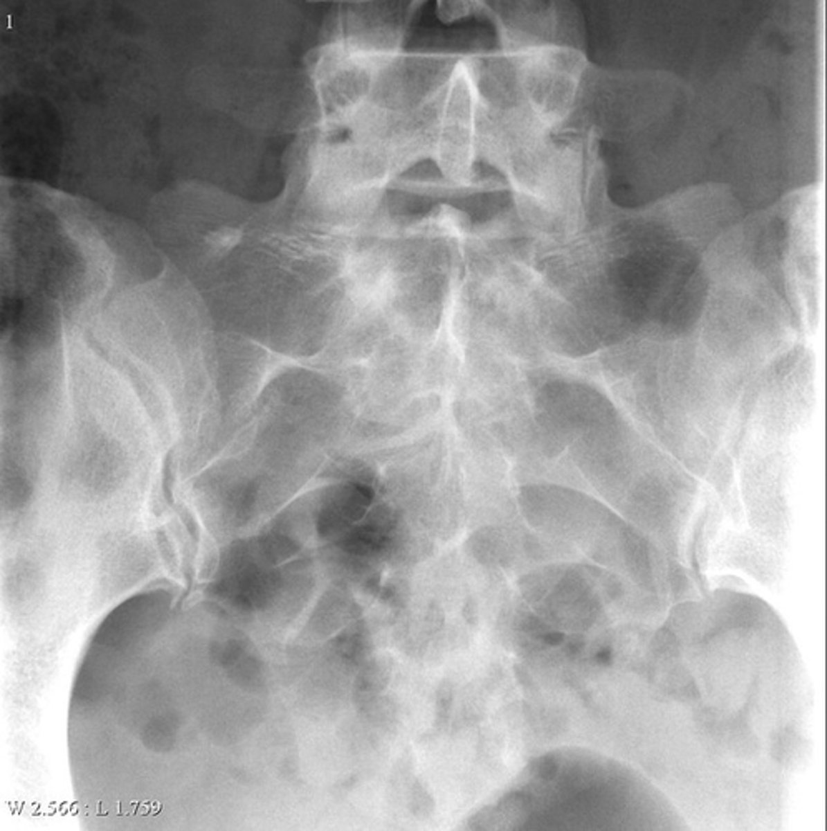 <p>Describe the lesion</p>