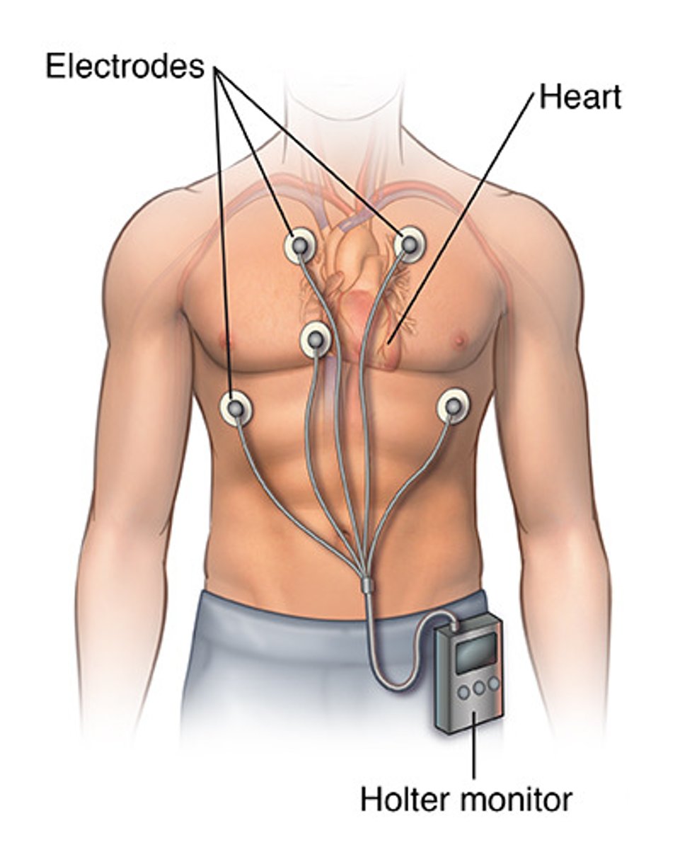 <p>continuous monitor, can pick up changes in conduction</p>